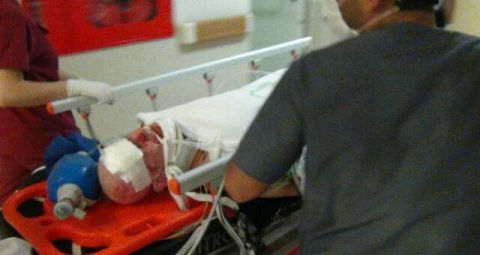 18 yaşındaki motosiklet sürücüsü ağır yaralandı