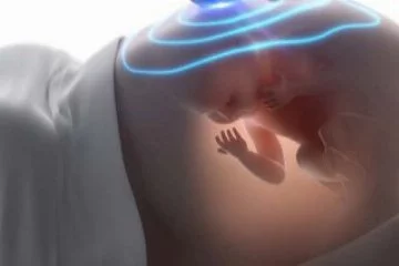 Emzik bebeğin gelişimini etkiler mi?